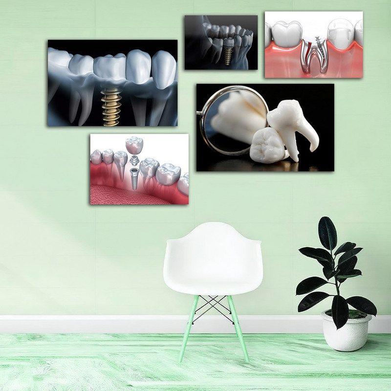 تابلو شاسی بکلیت طرح ایمپلنت و دندان پزشکی مدل SH-931 مجموعه 5 عددی